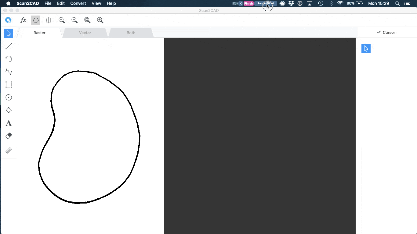 Raster profile of tumour converted to vector