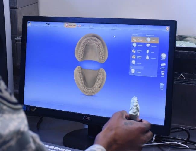 scan of set of teeth on computer